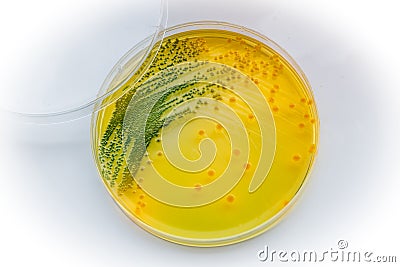 Vibrio cholerae:Gram-negative, comma shaped bacterium. Stock Photo