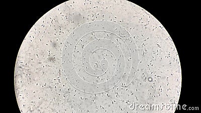 footage sperm Free lab footage sperm Free lab
