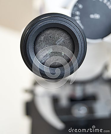 View in the microscope on fungi candida albicans. Selective focus on the eyepiece. Stock Photo