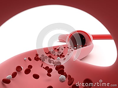 View of a sliced open blood vessel Stock Photo