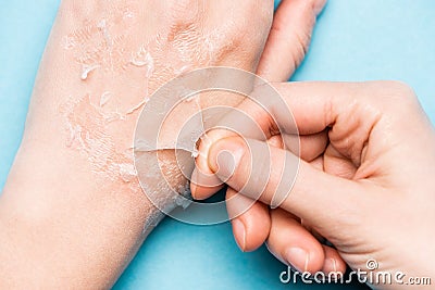 View of woman peeling off exfoliated Stock Photo