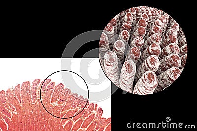 Villi of small intestine Cartoon Illustration