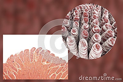 Villi of small intestine Cartoon Illustration