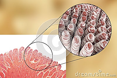 Villi of small intestine Cartoon Illustration