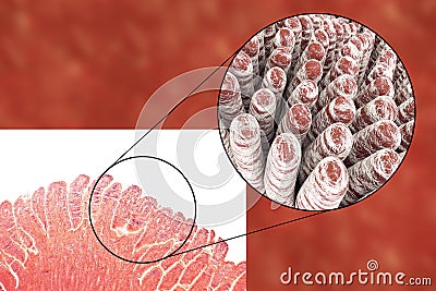 Villi of small intestine Cartoon Illustration