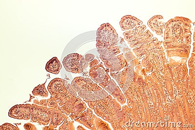 Villi of small intestine Stock Photo
