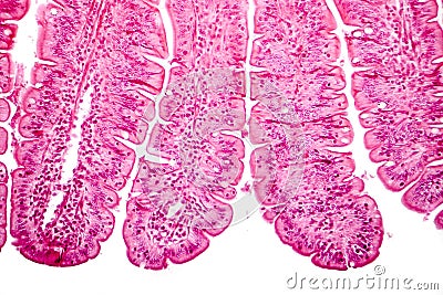 Villi of small intestine, light micrograph Stock Photo