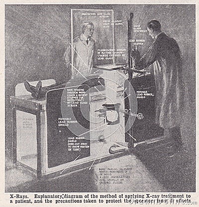 Vintage illustrations of the X-Ray 1930s. Editorial Stock Photo