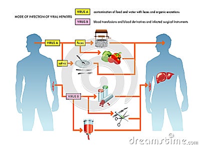 Viral hepatitis illustration Vector Illustration