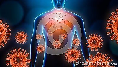 Viral pneumonitis 3d rendering illustration with red virus cells and human body. Coronavirus, covid 19, infectious and Cartoon Illustration