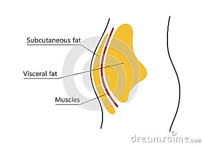 Visceral and subcutaneous fat around waistline. Location of visceral fat in abdominal cavity. Types of human obesity Vector Illustration