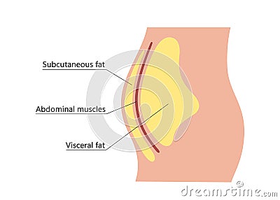 Visceral and subcutaneous fat around waistline. Location of visceral fat in abdominal cavity. Types of human obesity Vector Illustration