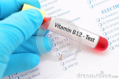 Vitamin B12 test Stock Photo