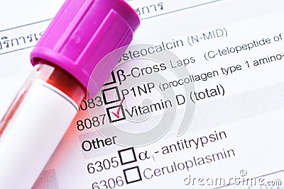 Vitamin D test Stock Photo