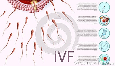 In Vitro Fertilization Informational List, Banner Vector Illustration