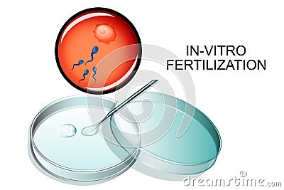 In-vitro fertilization. Vector Illustration