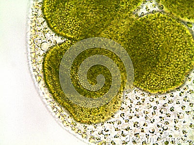 Volvox algae under microscope - 400x Stock Photo