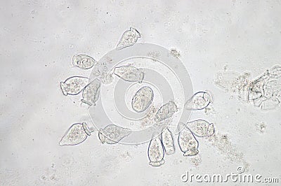 Vorticella is a genus of protozoan Stock Photo