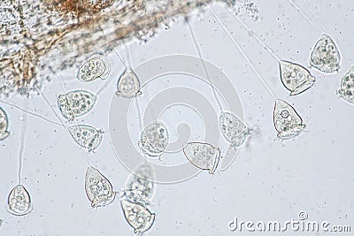 Vorticella is a genus of protozoan under microscope view. Stock Photo