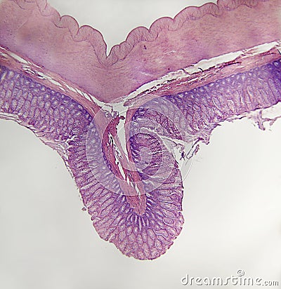 Wall large intestine mammal Stock Photo