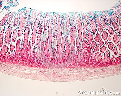 Goblet cells. Intestinal epithelium Stock Photo