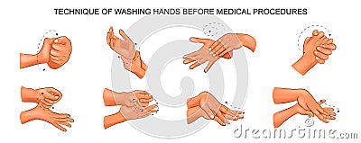 Washing hands before medical procedures Vector Illustration