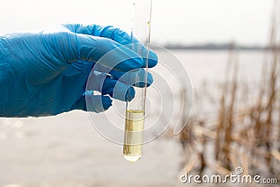 Water testing for infections Stock Photo