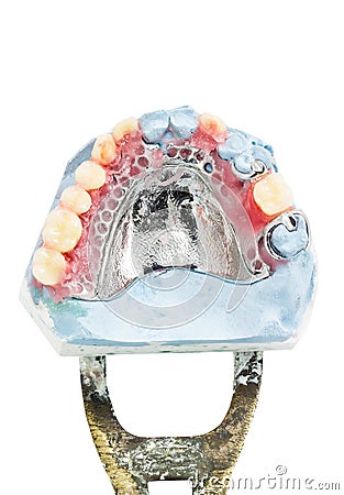 Wax partial denture,dental models showing Stock Photo