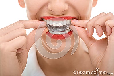 Wearing orthodontic silicone trainer Stock Photo