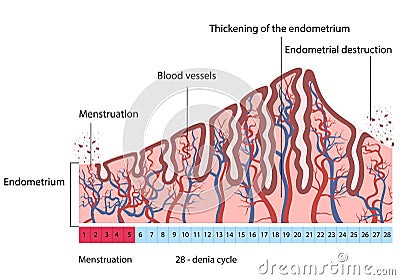 Changes in uterine endometrial destruction Vector Illustration