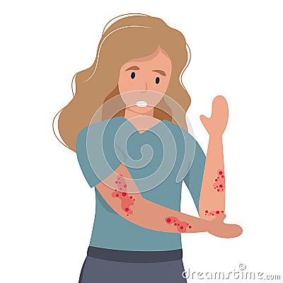 Woman with strong allergy symptoms. Cartoon sad character scratching skin, itching and suffering. Virus disease and eczema concept Vector Illustration