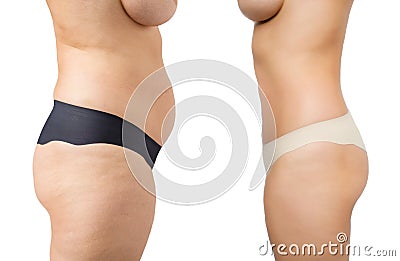 Before and after weight loss Stock Photo