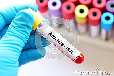 West Nile test Stock Photo