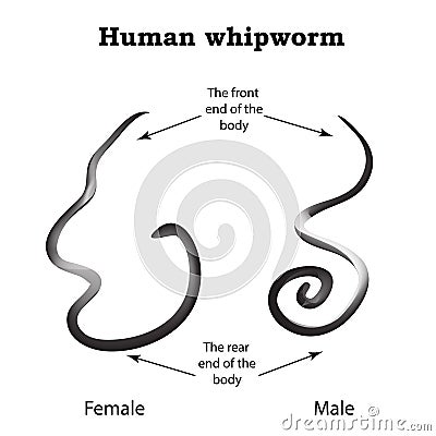Whipworm. Structure whipworm females. The structure of the male whipworm. Infographics. Vector illustration on isolated Vector Illustration