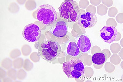 White blood cells in blood smear Stock Photo