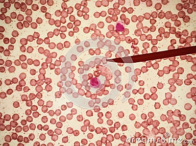 Blood leukocytes Stock Photo