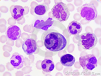 White blood cells Stock Photo