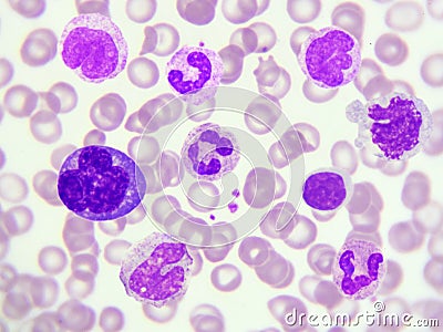 White blood cells Stock Photo