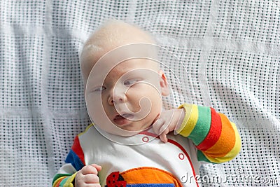 Whitehair babyboy with albinism syndrome Stock Photo