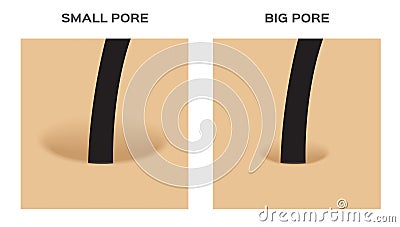 Wide and small hair follicle , pore . skin Vector Illustration