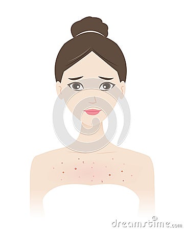 The woman with acne on chest vector illustration isolated on white background. Cartoon Illustration