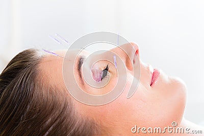 Woman at acupuncture with needles in face Stock Photo