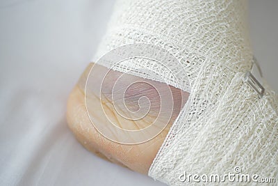 Woman with bandaged foot on bed Stock Photo