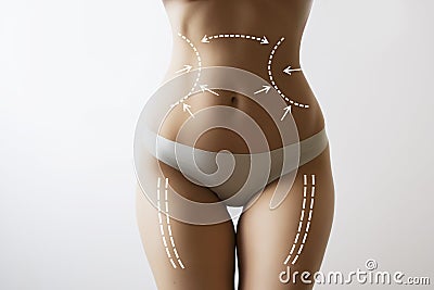 Slim woman body with marks on stomach Stock Photo