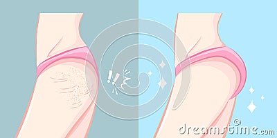 Buttocks with plastic surgery concept Vector Illustration