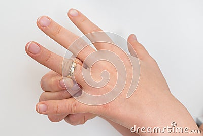 Woman cannot take off stuck wedding ring Stock Photo