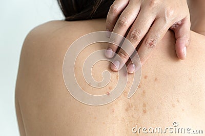 Woman with dermatology skin Dermatologist examining patient Stock Photo