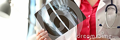 Woman Doctor Holding Right Hand Bone X-ray Image Stock Photo