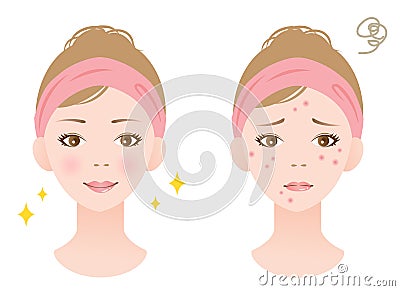 woman face before and after acne treatment procedure. Skin care concept Vector Illustration
