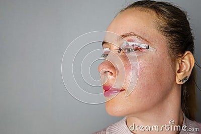 woman face after plastic surgery, blepharoplasty operation, swelling eye bags, incisions with removable stitches Stock Photo